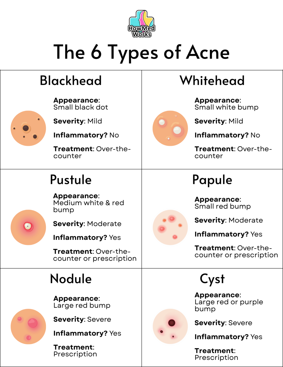 The 6 Types Of Acne How To Tell If Your Acne Is Mild Moderate Or